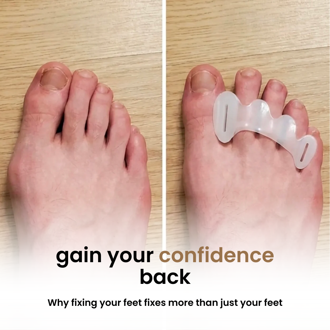 Toe Separator